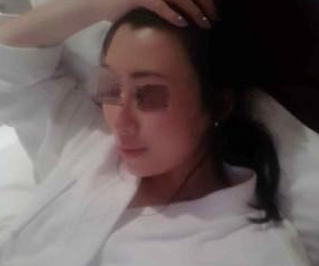 面部填充 美麗離我也不是很遠 - 珍美網(wǎng)