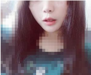 激光嫩膚 愛自己也要學(xué)會美麗自己