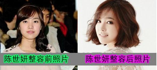 韓女星陳世妍整容前后對比 清純女神也需要改善的 - 珍美網(wǎng)