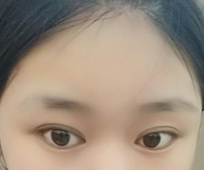 三點雙眼皮 閃閃的大眼眸真的美翻了