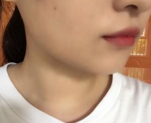 瘦臉針  讓男人目不轉(zhuǎn)睛的氣質(zhì)女 - 珍美網(wǎng)