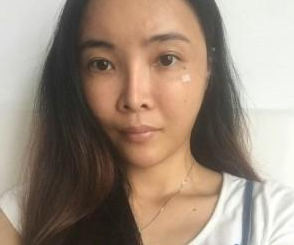 自體脂肪填充  重新找回美麗動(dòng)人的我 - 珍美網(wǎng)