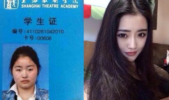 張景琪整容對比 乍一眼看有點快女“付夢妮”視感