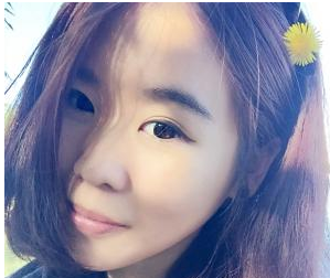 玻尿酸隆鼻   擁有俏麗的鼻子真美麗 - 珍美網(wǎng)
