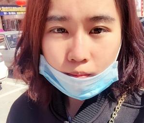 玻尿酸隆鼻   擁有俏麗的鼻子真美麗 - 珍美網(wǎng)