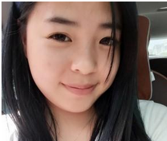 肉毒素瘦臉+墊下巴  完美的臉型我也值得擁有 - 珍美網(wǎng)