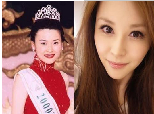穆熙妍整容前后  億萬千金讓蔡康永都驚訝 - 珍美網(wǎng)