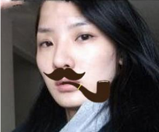 玻尿酸多部位面部填充  重現(xiàn)年輕美貌精致的自己 - 珍美網(wǎng)