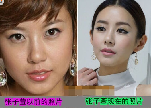 張子萱整形對比照 跟陳赫奉子成婚“辣媽”誕生 實現(xiàn)事業(yè)愛情雙豐 - 珍美網(wǎng)