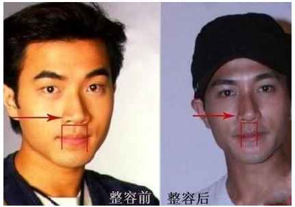 劉愷威整形了嗎 難怪越來越型男啦 - 珍美網(wǎng)