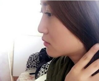 韓國伊婉大分子玻尿酸隆鼻 變側(cè)顏美麗小仙女 - 珍美網(wǎng)