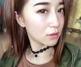 韓國伊婉大分子玻尿酸隆鼻 變側顏美麗小仙女