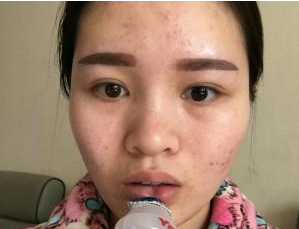 半永久紋眉術  讓我大發(fā)光彩實現(xiàn)美麗愿望 - 珍美網(wǎng)