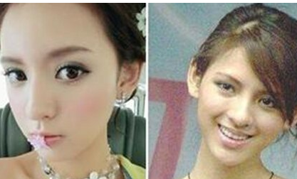王思聰前女友張予曦整容前后對比 事業(yè)愛情雙豐收 - 珍美網(wǎng)