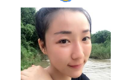 豐全臉手術(shù)  讓我膠原蛋白滿滿光彩照人 - 珍美網(wǎng)