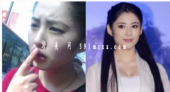 李心艾到底整容了嗎？不過照片前后對(duì)比真的慘不忍睹