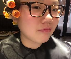 玻尿酸注射隆鼻  讓我找回美麗的自信 - 珍美網(wǎng)