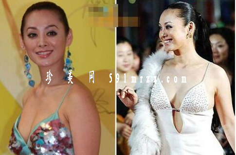 寧靜隆胸了嗎？ 爽快干練的性格真的非常讓網(wǎng)友喜愛 - 珍美網(wǎng)