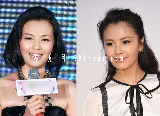 劉濤整形了嗎?  那么如何顏值逆襲了