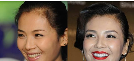 劉濤整形了嗎?  那么如何顏值逆襲了 - 珍美網(wǎng)