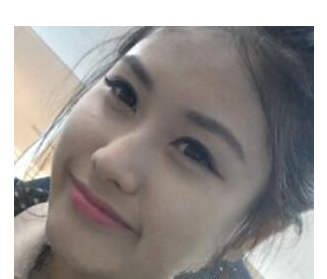 假體隆鼻  實(shí)現(xiàn)更加美麗動(dòng)人的自己 - 珍美網(wǎng)