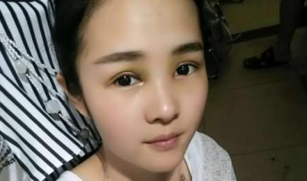 雙眼皮手術(shù)  讓我更加美麗迷人 - 珍美網(wǎng)