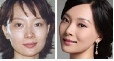 看了陳數(shù)的前后對(duì)比照 有沒有整容過呢？ - 珍美網(wǎng)