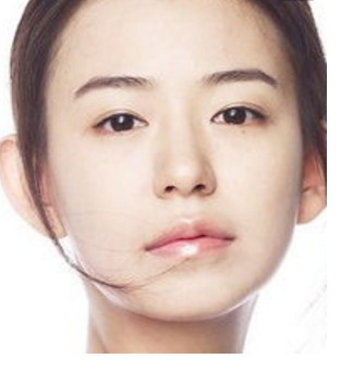 電波拉皮手術(shù)效果怎么樣 - 珍美網(wǎng)