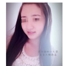 注射瘦臉針  小v臉值得擁有 - 珍美網(wǎng)