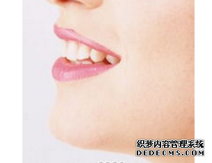 電波拉皮手術(shù)