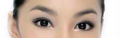割雙眼皮：局部麻醉or全身麻醉?