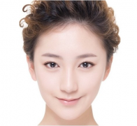 鼻翼再造方法介紹