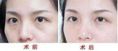 上海填淚溝多少錢？價格是多少？