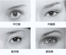 深圳雙眼皮哪家醫(yī)院好？