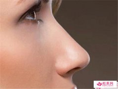 骨粉隆鼻整形美容后多久見效果？