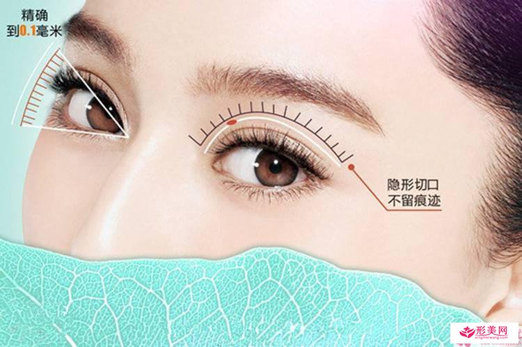 倒睫雙眼皮術(shù)式手術(shù)后護理注意事項