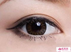 芭比眼雙眼皮成形術(shù)式之前需要注意