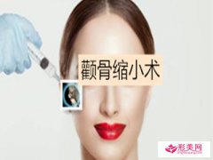 顴骨怎么變小