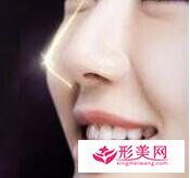 在廣州做假體隆鼻的價格是多少