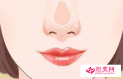 做鼻頭縮小手術(shù)要多少錢？