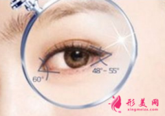 做開眼角手術(shù)要花多少錢？
