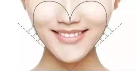 自體脂肪填充有害嗎