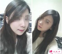 瘦臉的有效方法_每天怎么做可以瘦臉？