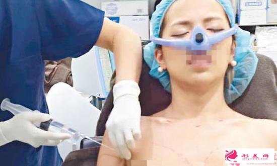 假體隆胸注意事項(xiàng)_哪些人不適合做假體豐胸