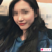 上海磨骨瘦臉的價格是多少？