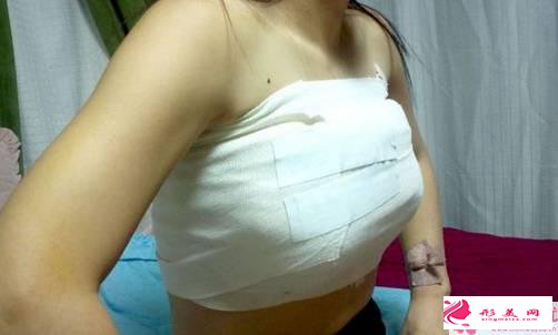 假體隆胸后的護(hù)理_假體隆胸后該如何按摩乳房？