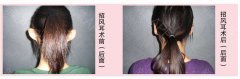 做耳部異常糾正治療的消費高嗎?