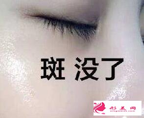 怎么樣才可以快速祛斑