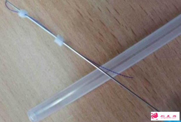 埋線提升的線材多久會(huì)被吸收
