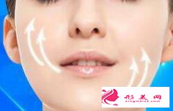 埋線提升的線材多久會(huì)被吸收